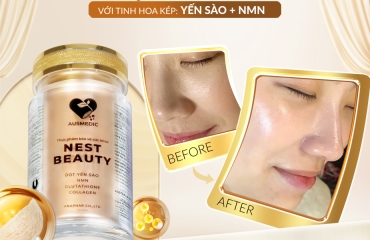 Nest Beauty Có Tốt Không? Đánh Giá Khoa Học Chi Tiết Từ Chuyên Gia