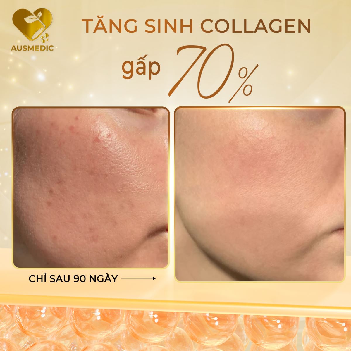Viên uống Yến Sào Nest Beauty: Tiện lợi như uống cà phê sáng, da đẹp không cần chưng cách thủy!