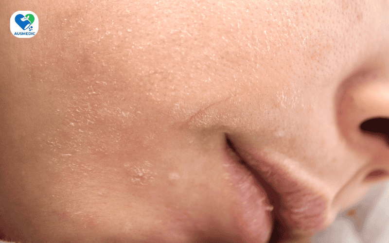 Da Mất Nước Mùa Hè: Dấu Hiệu Nhận Biết Và 7 Bước Phục Hồi Cấp Tốc