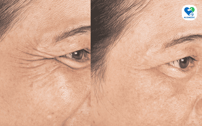NAD+ Là Gì? Tác Dụng, Lợi Ích & Cách Tăng Cường NAD