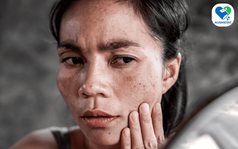 Uống cà phê có bị sạm da không? - Tìm hiểu ảnh hưởng và giải pháp bảo vệ làn da
