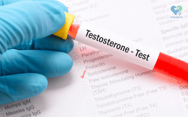 Testosterone là gì? Tác dụng của Testosterone đối với sức khỏe nam