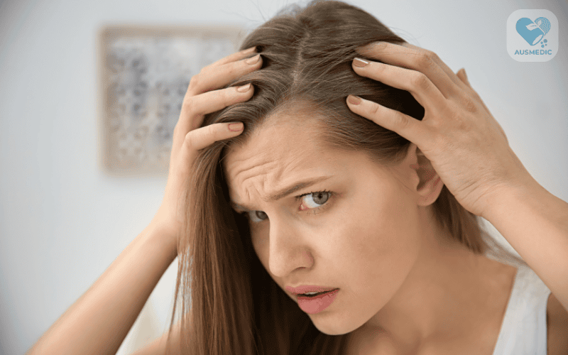 Dấu hiệu hói: Nhận diện sớm và cách khắc phục hiệu quả