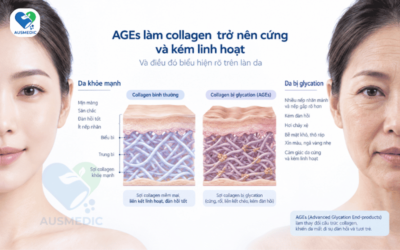 Glycation và lão hóa da: Khi đường chính là "thủ phạm" làm già hóa làn da