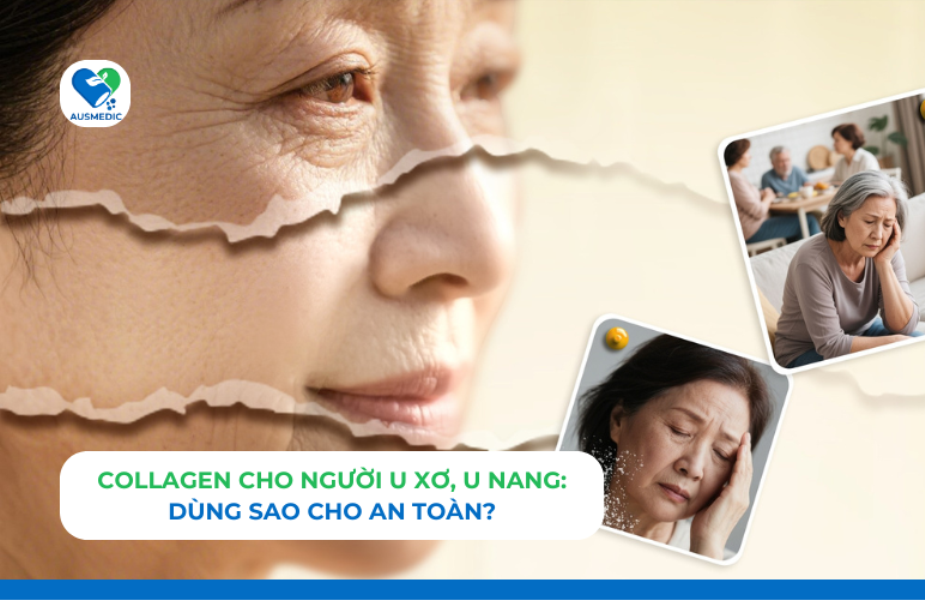 Collagen Cho Người U Xơ, U Nang: Dùng Sao Cho An Toàn?