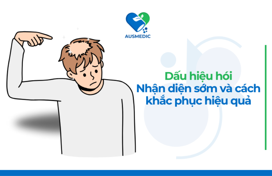 Dấu hiệu hói: Nhận diện sớm và cách khắc phục hiệu quả