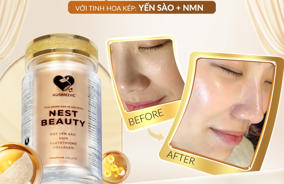 Nest Beauty Có Tốt Không? Đánh Giá Khoa Học Chi Tiết Từ Chuyên Gia