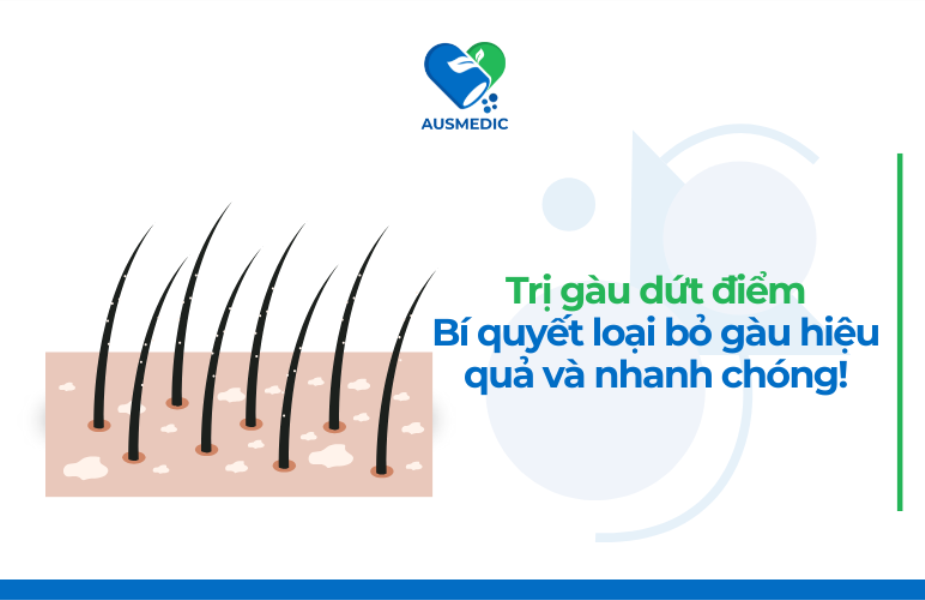 Trị gàu dứt điểm: Bí quyết loại bỏ gàu hiệu quả và nhanh chóng!